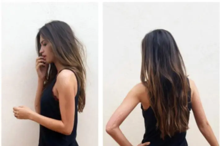 Las Cicatrices de Sara Carbonero Arrasan en Twitter