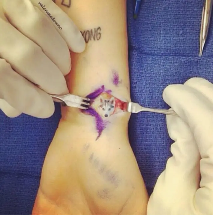 Las Múltiples Heridas de Miley Cyrus