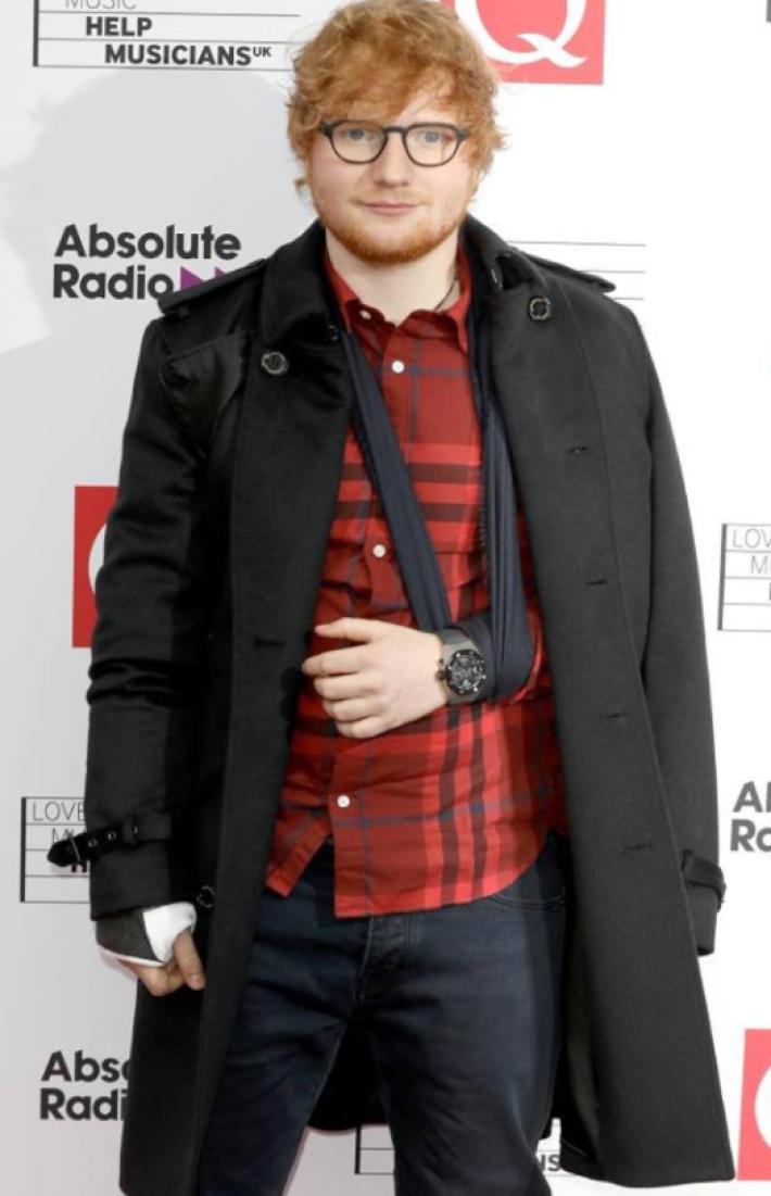 Ed Sheeran revela el inesperado lugar al que acudió tras su accidente